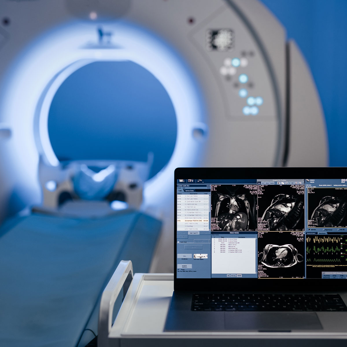AI-assisted MRI scan analysis displayed on a laptop in a medical imaging room.